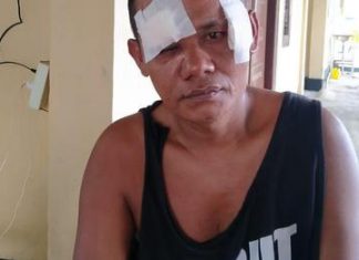 Warga Mukomuko Lapor Polisi Dikeroyok Rekan Kerja