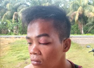 Pemuda Jambat Akar di Peras dan di Aniaya