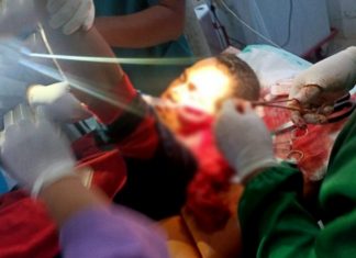 Istri Bacok Suami: Terduga Pelaku Sayat Lehernya Sendiri Nyaris Putus
