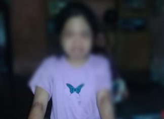 Miris! Diduga Pelaku Oknum Polisi Siksa dan Tak Bayar Gaji ART Warga BU