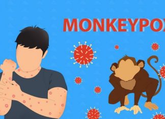 Bahaya Cacar Monyet, Pemkot Bengkulu Perluas Wilayah Sosialisasi Cacar Monyet Ilustrasi