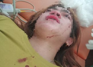 Tak Terima Akun Suaminya Diviralkan, Perempuan Ini Malah Dikeroyok