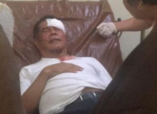 Terkena Lemparan Batu Orang Tak Dikenal Saat Ikut Pengantaran Jenazah Lukas Anembe, Pj Gubernur Terluka