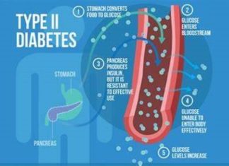 Penting Sebelum Terjadi Komplikasi Serius, Berikut 6 Cara Cegah Diabetes Tipe 2