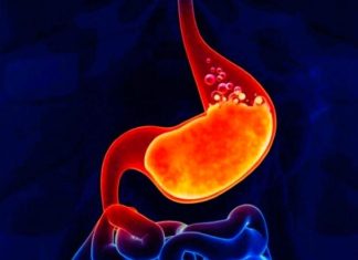 Benarkah Asam Lambung Bisa Menyebabkan Kematian? Simak Penjelasannya